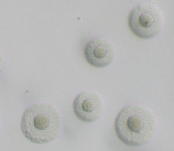 Imagen: Mycoplasma hominis (Fotografía cortesía de los Centros para la Prevención y Control de las Enfermedades de los EUA).